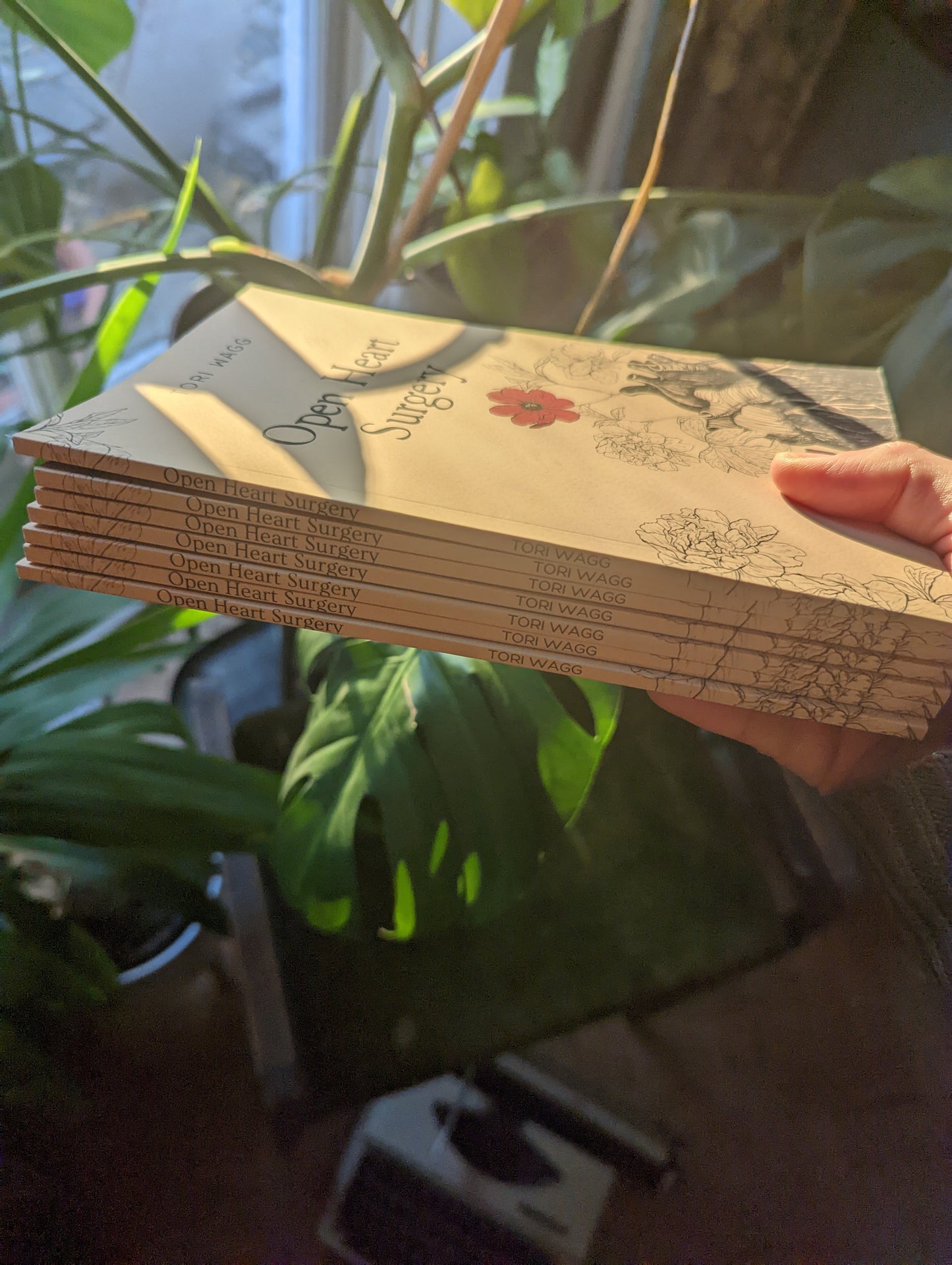 Open Heart Surgery -A collection of poems